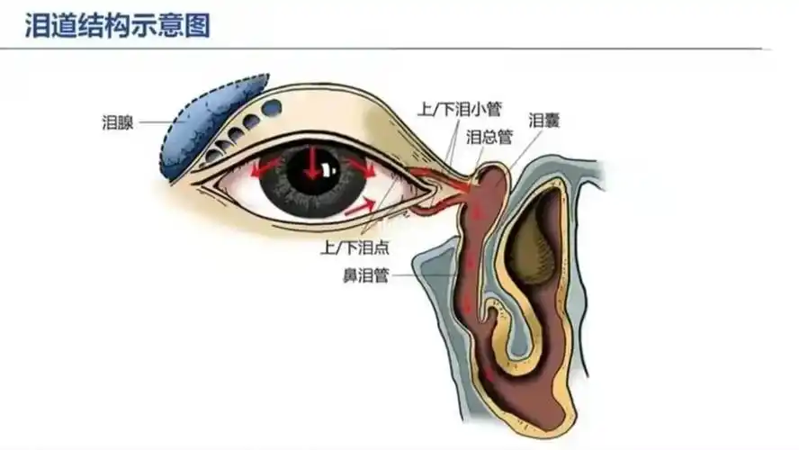 合肥爱尔眼科科普:有关于泪道疾病那些事_腾讯新闻