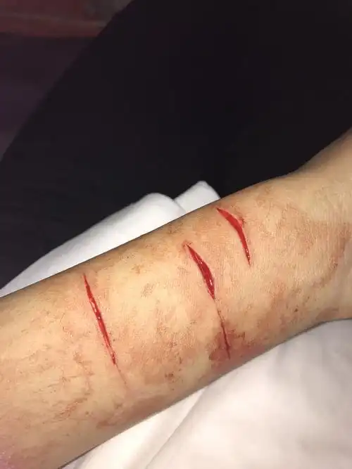 最近这段时间我跟我男朋友吵的比较厉害,这就是我在元旦被他逼的自己