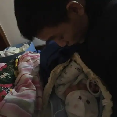 剖腹产刀口恢复.有图慎入.