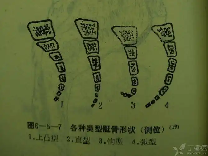 【求助】影像医生求助,骶尾骨正常解剖变异图片