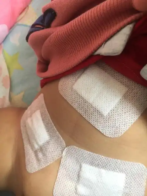 头条问答 - 两岁多小孩得了左侧腹股沟疝气,做手术一个月后右边又掉
