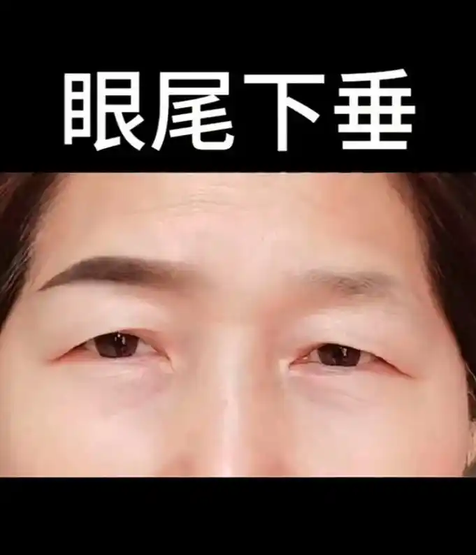 眼尾下垂,女性的眼睛略微下垂, 好似小狗之眼,说明此类人性格较为内向