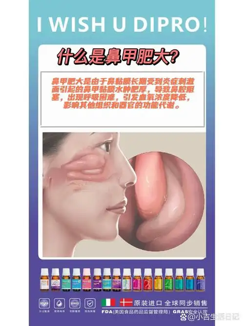 鼻甲肥大的治疗方法?手术治疗方法.