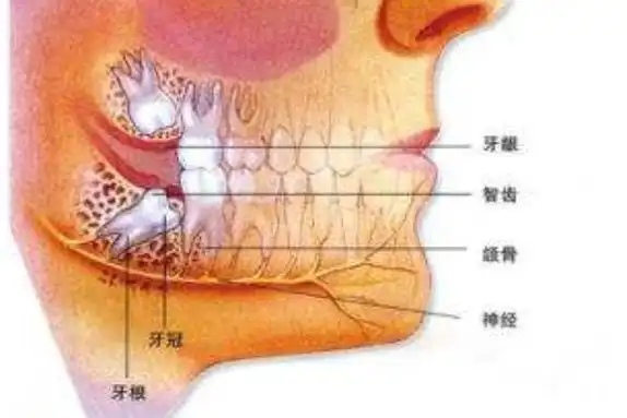 尽头牙一般都长在牙床的最里边,因此它被叫做尽头牙.