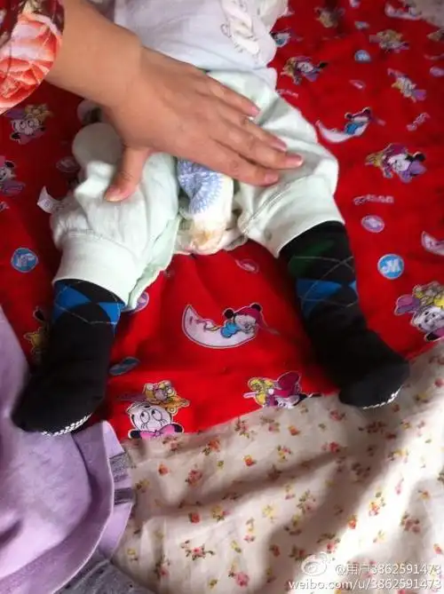 崔大夫我家宝宝4个月了前两天体检医生说宝宝下肢肌张力高,请您帮忙