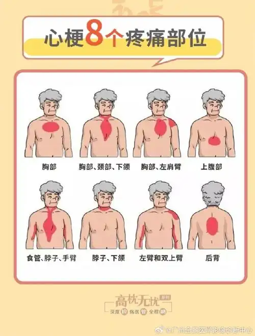 心梗就是心脏的"供水管",冠状动脉突然堵塞了,导致心肌严重缺血缺氧