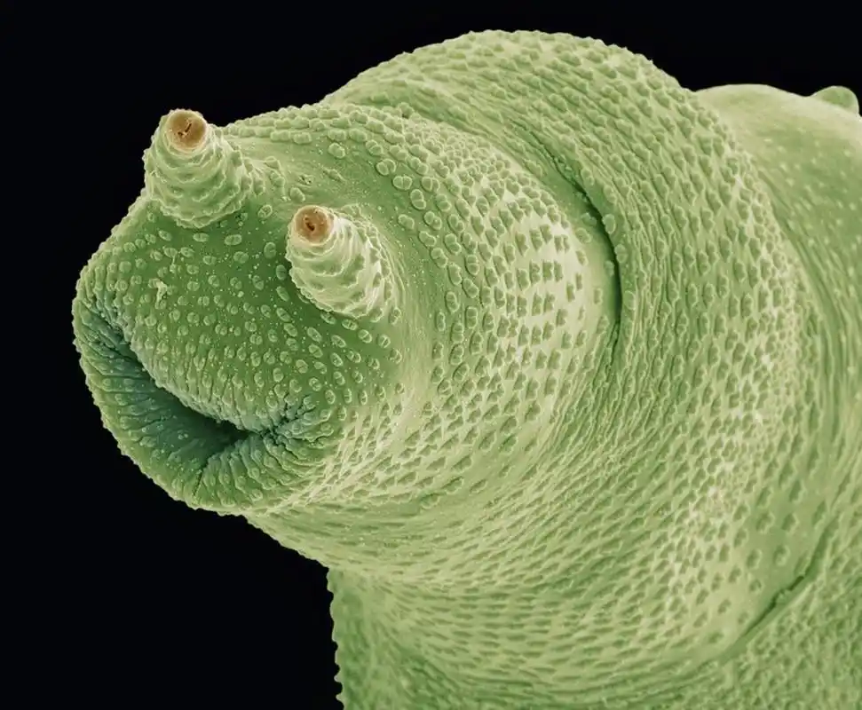 冰封2.4万年解冻后复活,通过电子显微镜观察到的蛭形轮虫.