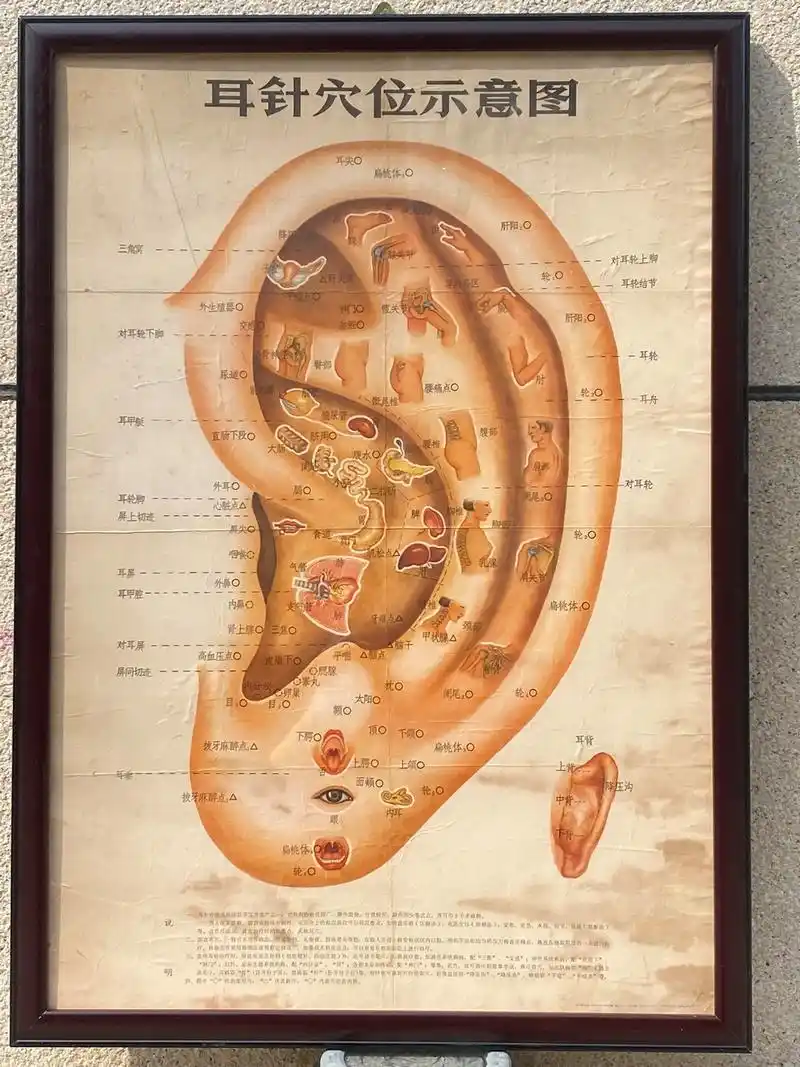 耳针穴位图(品如图,尺寸:82x58.3厘米)#传承中医文化 - 抖音