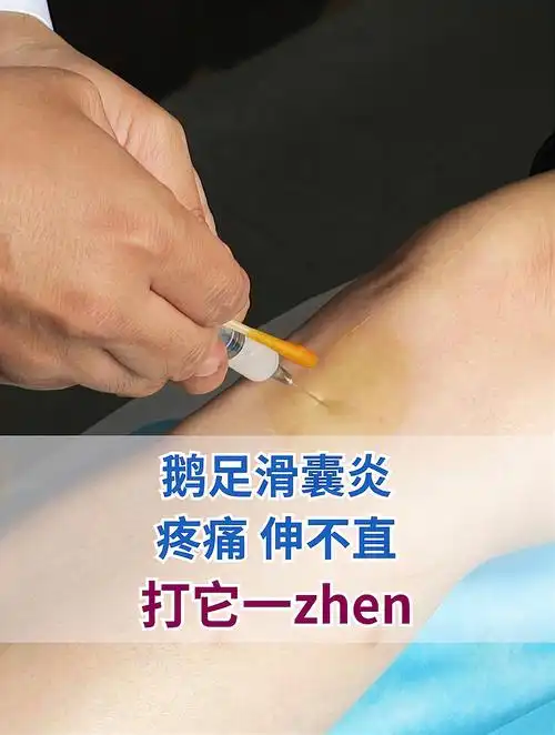 鹅足滑囊炎,疼痛,伸不直,打它一针!-度小视