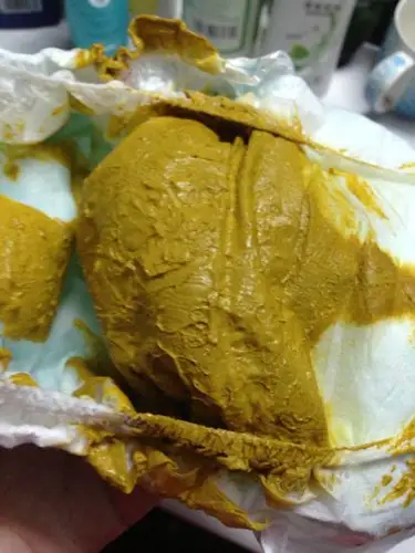 吃母乳婴儿的大便