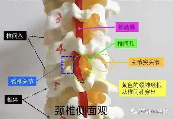 影像解剖 | 一图看懂颈椎钩椎关节