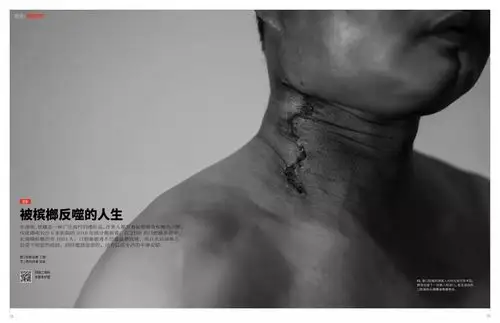 被槟榔反噬的人生