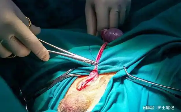 那些被结扎的男人,后来都怎么样了?结扎后是否可逆?医生来解惑