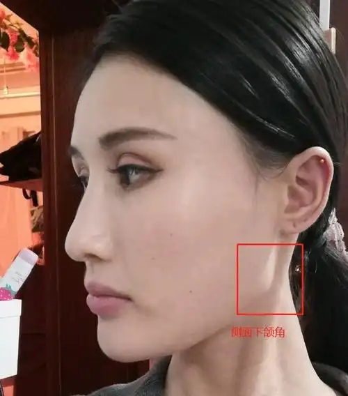 颧骨宽腮骨宽鼻子小的女人面相_颧骨很宽的女人面相_男生额头窄颧骨宽