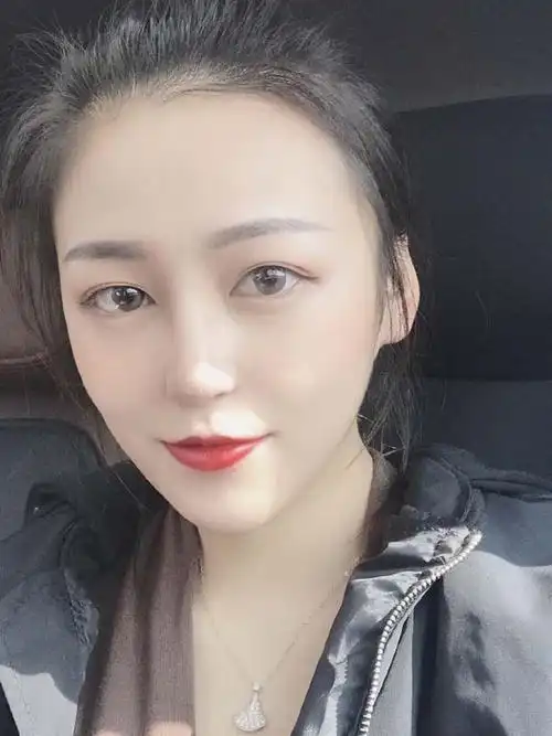 杭州艺星除皱瘦脸价格 黄高敏医生案例