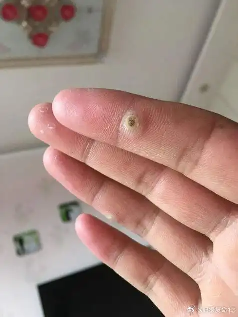 国医的精诚力量##论道岐黄##健康