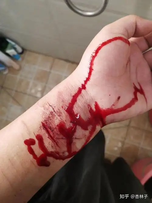 自残属于什么心理