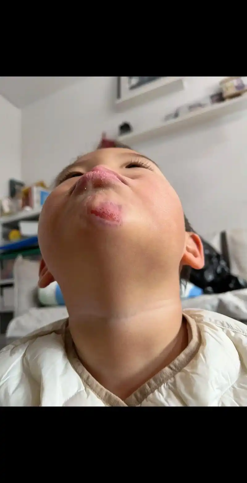 第一次下巴磕成这样……天气太冷了,学哥哥手插口袋上楼梯,还不 - 抖