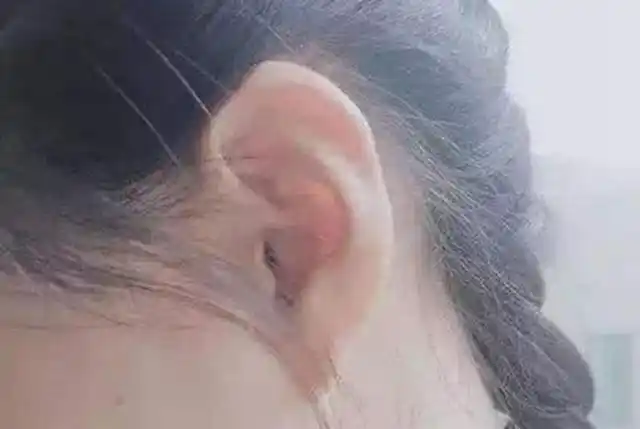 "穷人耳""富人耳"有没有科学依据呢?耳朵如何保健呢?