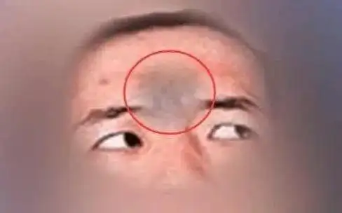 脸上这个位置发黑,近期易有意外发生,特别是在出行方面!