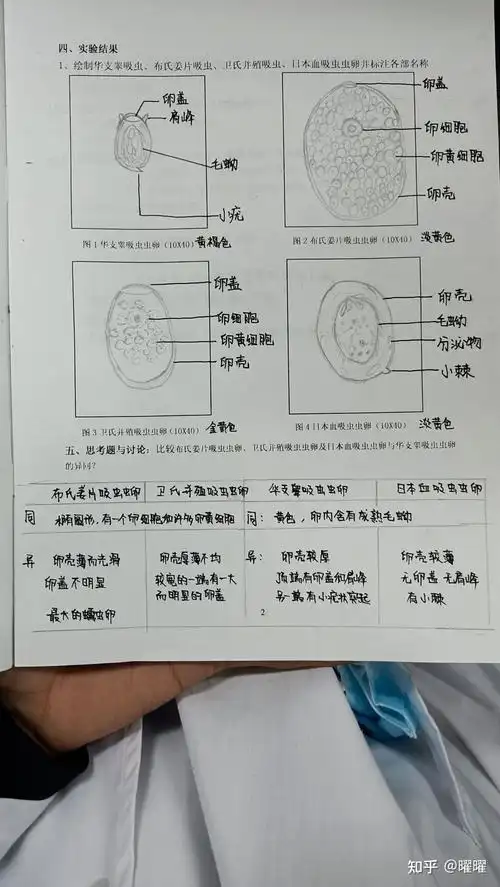 华支睾吸虫虫卵,布氏姜片吸虫虫卵,卫氏并殖吸虫虫卵,日本血吸虫虫卵