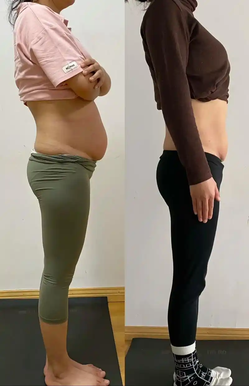 大肚腩变小蛮腰 #产后功能修复 #产后宝妈 #减肥前后对比 - 抖音