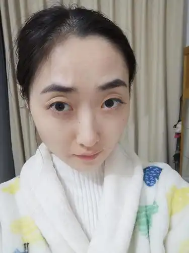 大圆脸大头发际线高大小眼怎么破嘤嘤嘤 大家帮我.