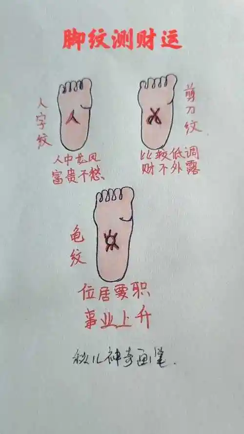 看看你的脚底纹是什么样的对比一下