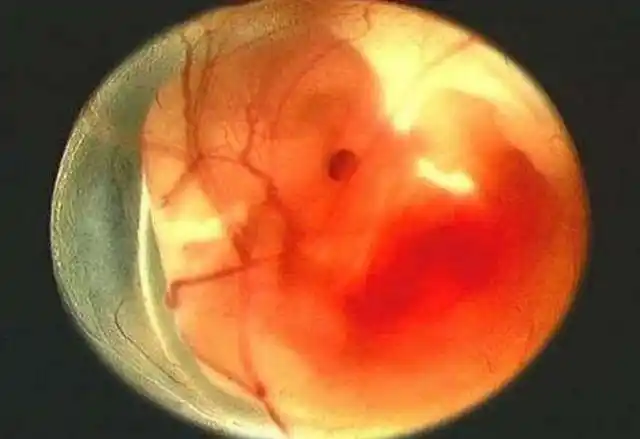 怀孕2个月,进入胎儿发育的"转折点",孕妇须注意4个问题