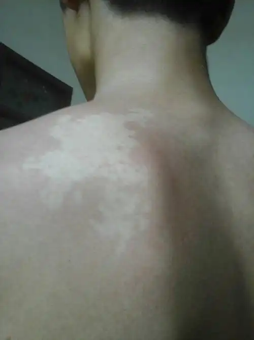 以前很小就没在意,今天一看就很大了,这片的皮肤很白