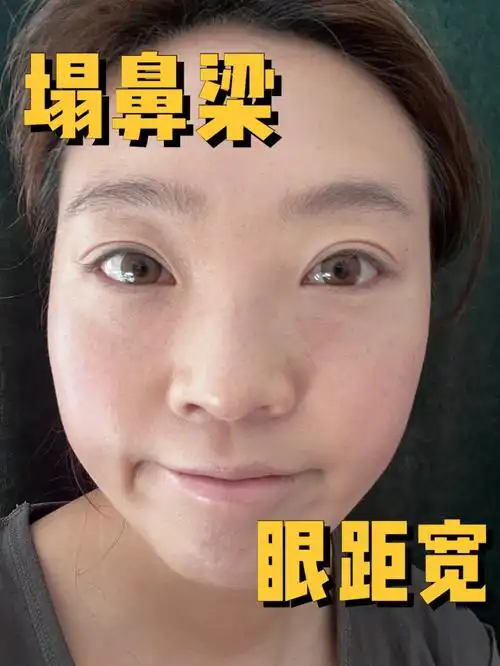 01塌鼻梁眼距宽欧美换头妆