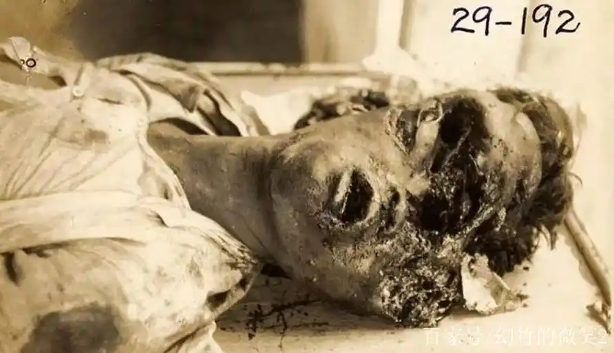 731部队老照片:图2女性等待活体被解剖,最后这张才是残忍至极!