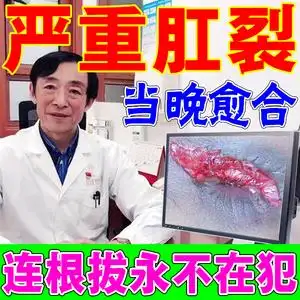 肛裂愈合膏外用日本治疗肛瘘肛窦炎肛周脓肿硬块大便出血痔疮药膏