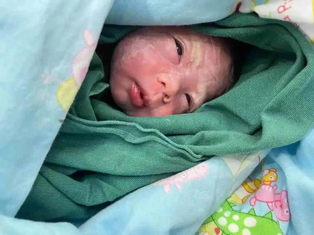 33周早产宝宝 #12月31号的小虎仔11月18号提前退房 - 抖音