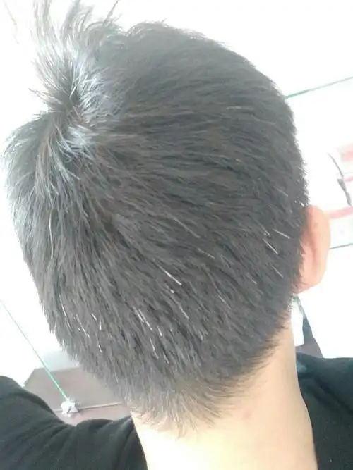 明明很年轻为什么白头发越长越多真的会拔一根长十根吗