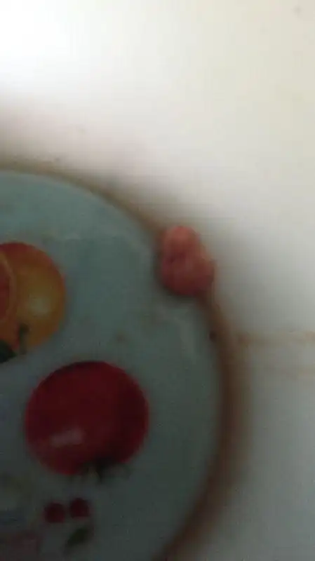 我今天药流去医院吃了药30分钟就排出了白色的像小孩的东西… 请问下