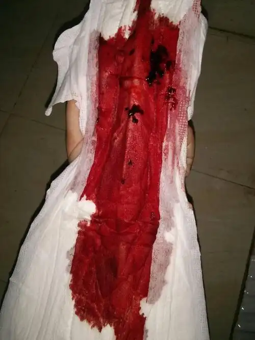 请问我这个月经正常吗