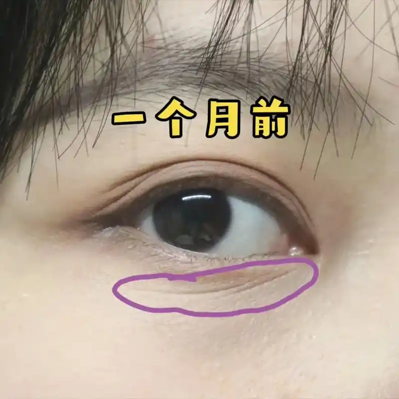 抖音图文来了 一个低成本不到三毛的小方法,让你眼睛回到十八岁