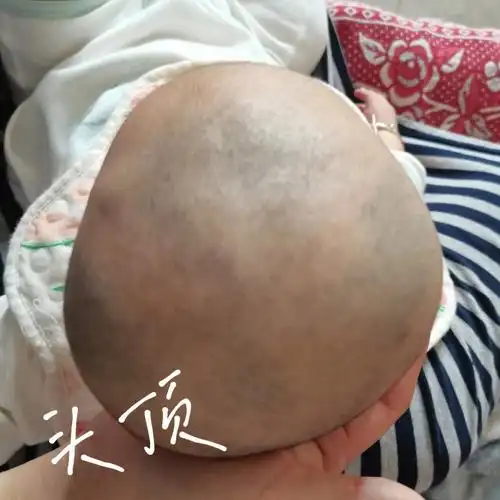 三个多月宝宝偏头01