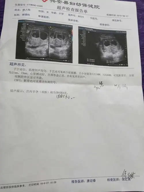 双胞胎8周5天了,看看我这b超单正常吗?