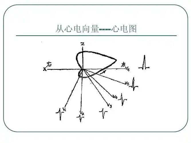 临床心电向量图-沈絮华ppt