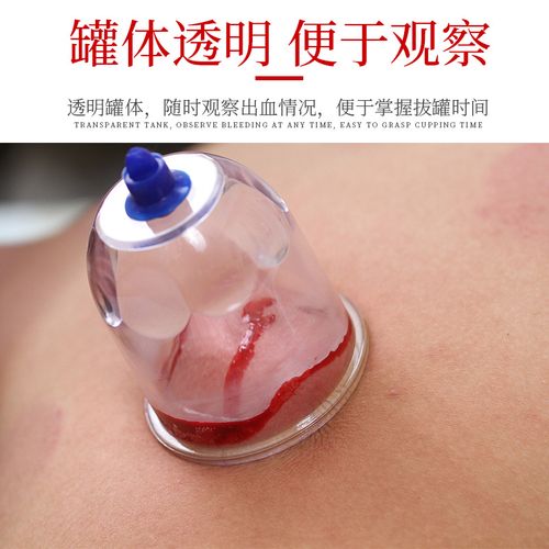 泻血刺络放血真空拔罐家用抽气气罐心天排淤拔拔罐器器械