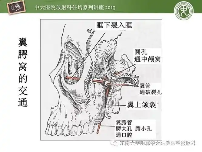 翼腭窝的影像解剖及临床意义