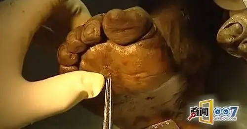 农田里挖出千年女尸皮肤柔滑保存完好