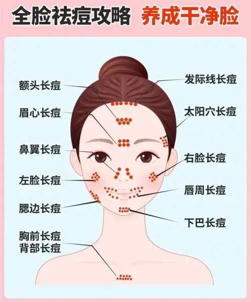 保姆级祛痘攻略秒懂长痘原因痘痘肌必看