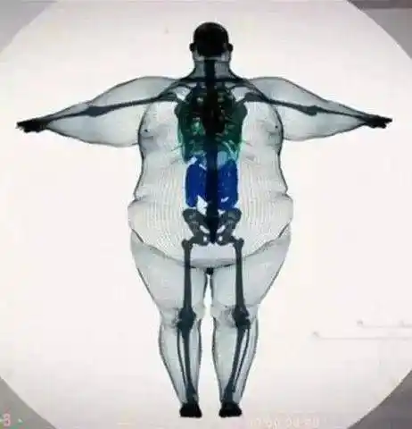 骨架大小和胖瘦没有什么直接关系,人体全身骨头共有206块,约占全身