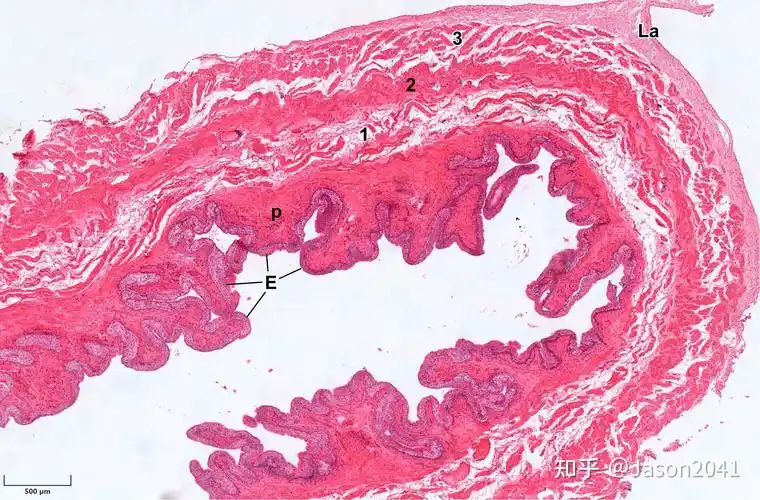 膀胱变移上皮的微观形态