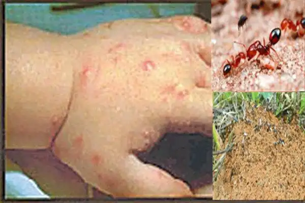 红火蚁的危害有哪些?灭治红火蚁