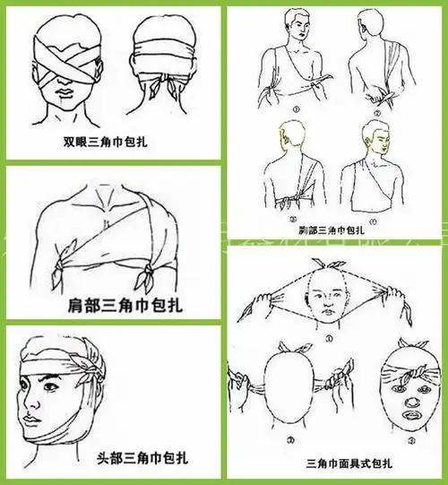 4,肩部包扎法:把三角巾一底角斜放在胸前对侧腋下,将三角巾顶角盖住后