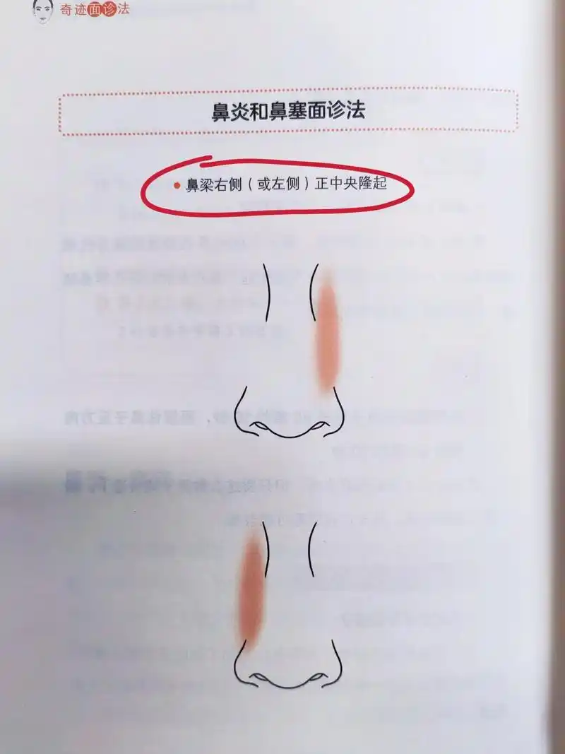黄帝内经讲要注意鼻梁两侧的隆起#中医养生 #黄帝内经 #面诊